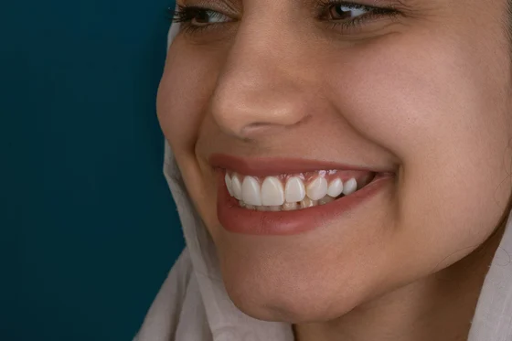 Close-up of a bright white smile