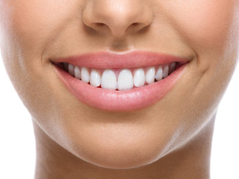 smile-anatomy-min